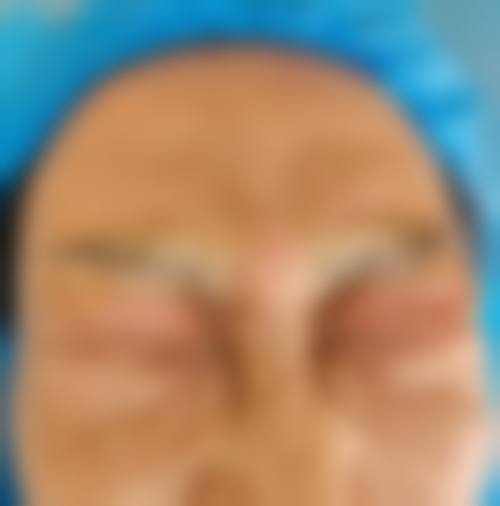 陈怡皆医生项目价格表参考