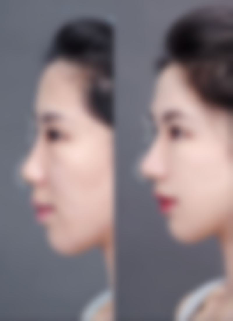 经常拍打眼部下方，具体该咋操作？