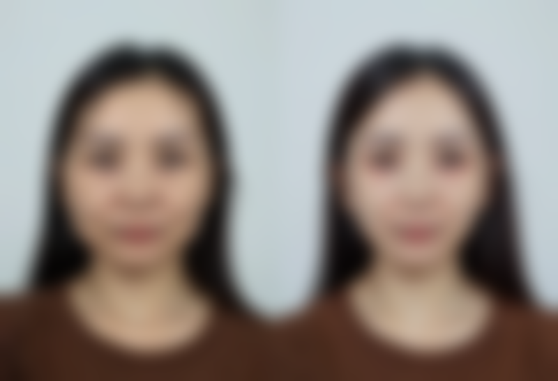 八、重庆万君医疗美容诊所真实的顾客评价如下：