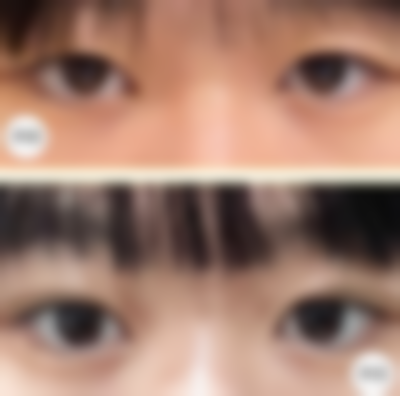 七、韩国IQ整形外科价格表:(仅供参考)