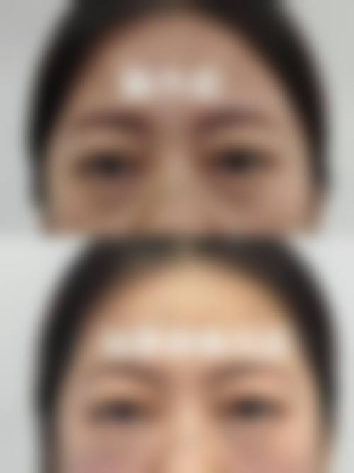 八、阜阳斯尔美千悦医疗美容门诊部真实的顾客评价如下：