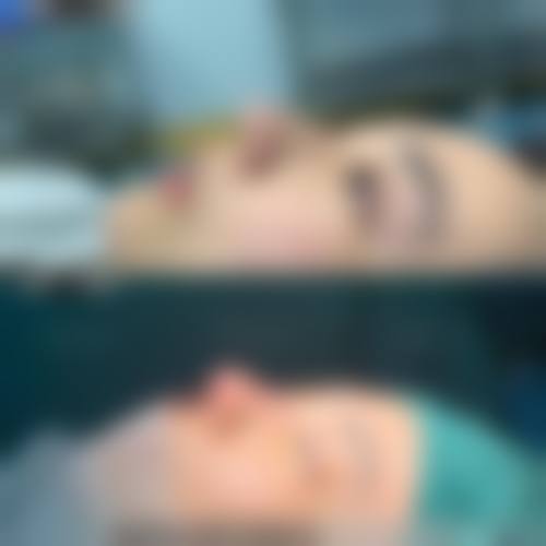 五、青岛爱美丽医疗整形医院实例