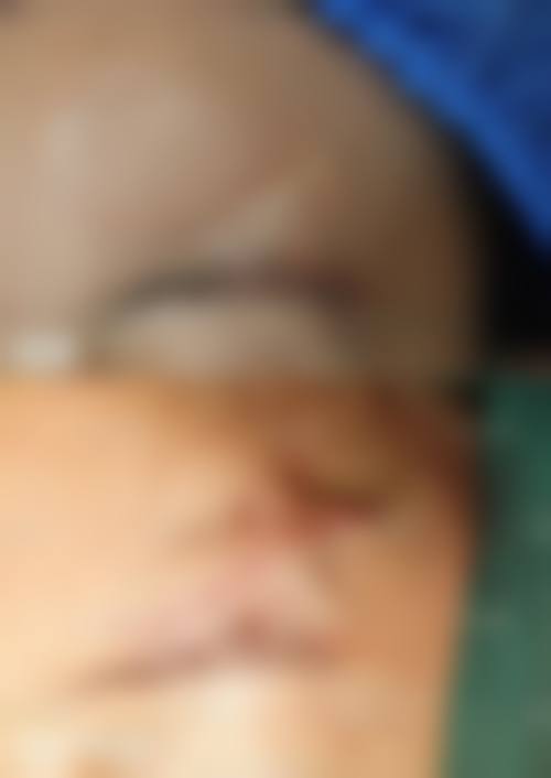 五、河南省整形美容研究中 心实例