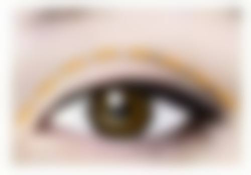 突然双眼皮肿了，有哪些缓解与治疗方法？