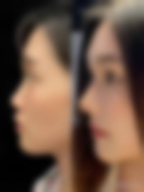 八、梅州爱丽诺医疗美容整形门诊部真实的顾客评价如下：