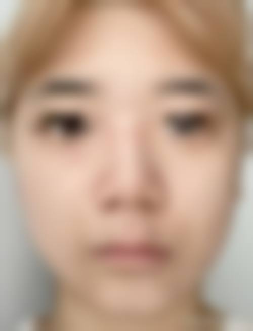 七、新疆阳光天使整形医院价格表：（仅供参考）