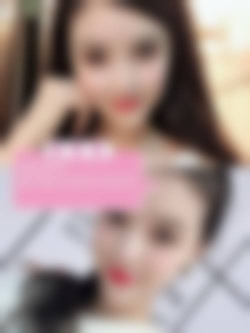 七、深圳华美整形医院真实的顾客评价如下：