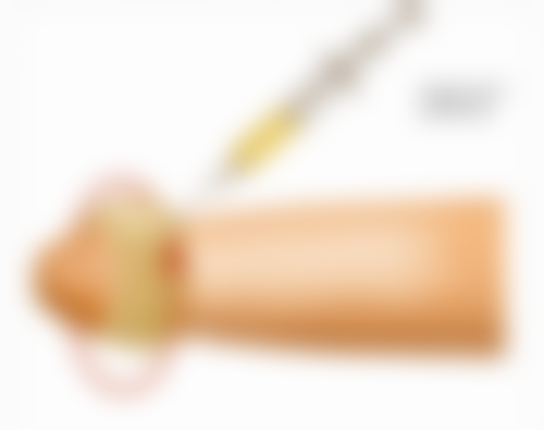 隆胸后究竟能否给小孩喂奶？解析不同隆胸方式对母乳喂养可行性及注意要点