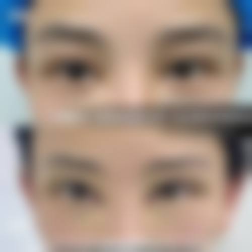 四、南阳宛城仁康医院医疗美容科实例