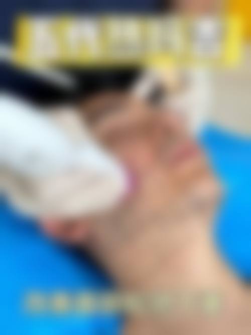 五、太原悦薇美妍医疗美容诊所实例