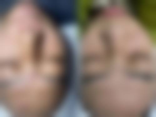 七、北京壹希光合医疗美容诊所价格表:(仅供参考)