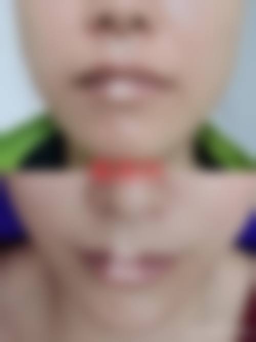 李舒倩医生口碑和评价