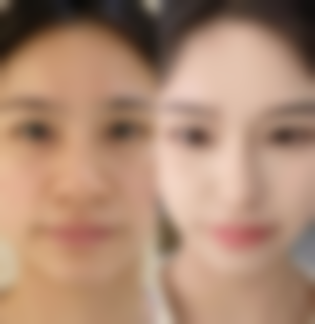 五、兰州军区总医院实例