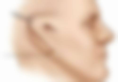 如何摆脱黑眼圈黑眼袋？多维度方法助你改善循环、紧致肌肤，告别熊猫眼！ 