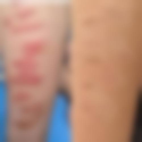 张利红医生怎么样可靠吗？