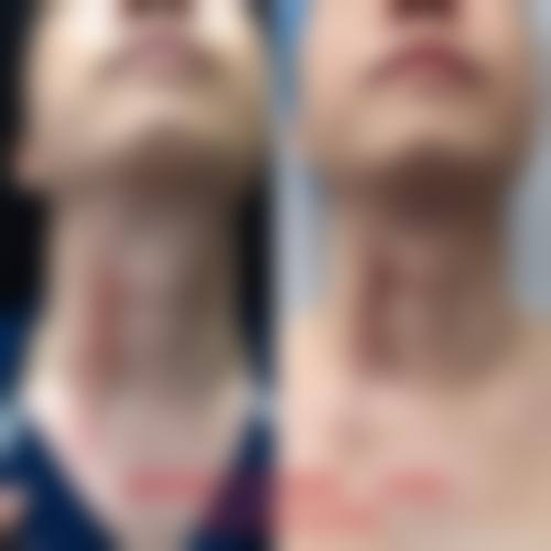 张利红医生实例