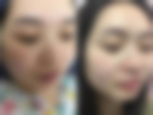 六、大庆诺妍医疗美容门诊部怎么预约：