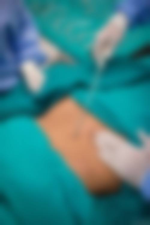 胡瑾医生怎么样可靠吗？