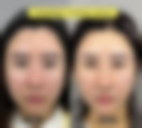 六、合肥真年轻美伦医疗美容诊所怎么预约: