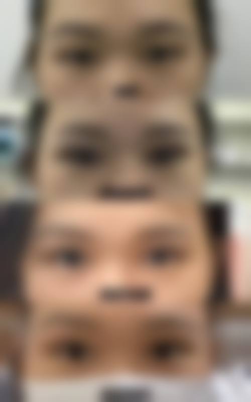 四、苏州100医院整形美容科实例