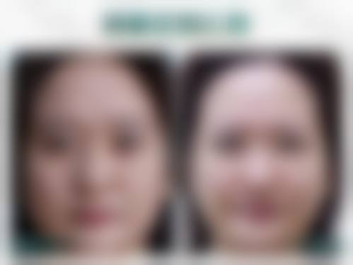 五、苏州100医院整形美容科怎么预约