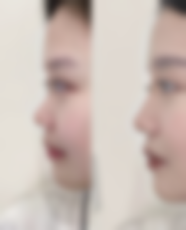 四、郴州禾美荟医疗美容门诊部开展的主要项目和特色项目：