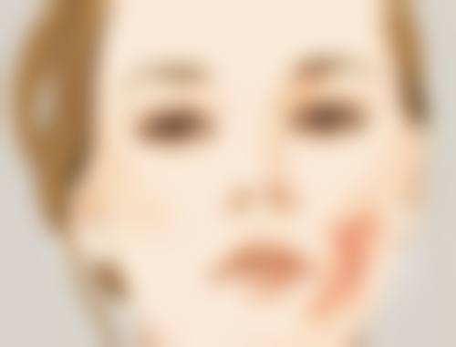 医美手段,快速有效消除眼袋