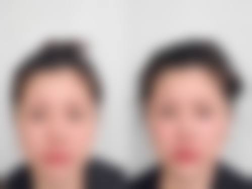 七、日喀则鑫鑫医疗美容诊所价格表：（仅供参考）