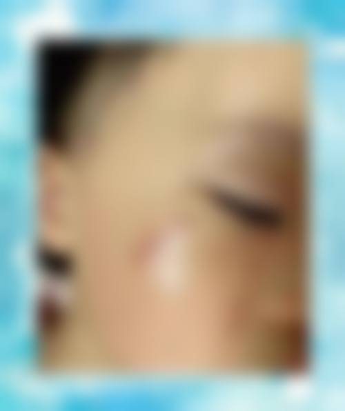 尹朝奇医生实例