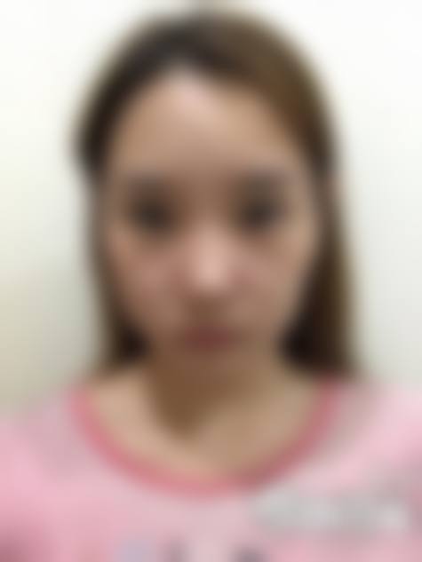 五、istar整形外科怎么预约：