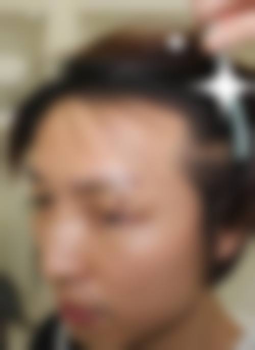 五、贵阳熊本漾悦整形医院怎么预约：