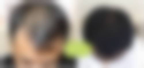 五、江西赣州田美（原星范）医疗美容实例