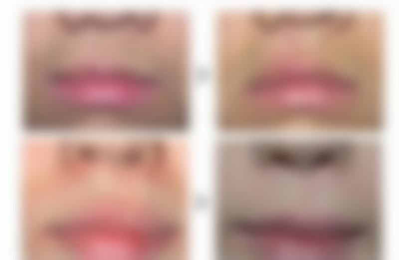 尹朝奇医生怎么预约？