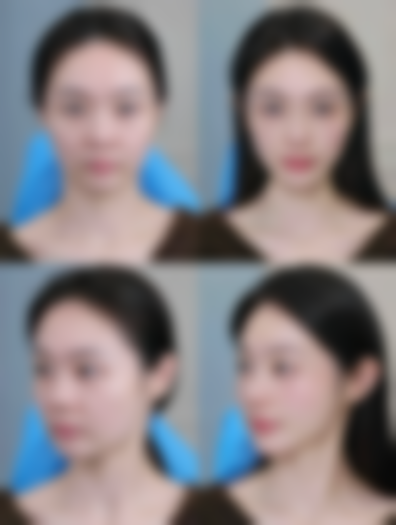 垮脸的具体表现及成因,你知道多少?