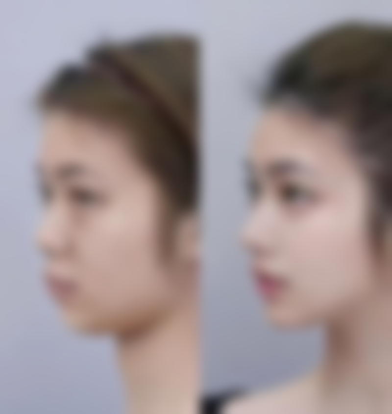 垮脸了怎么办?修复与改善方案来救你