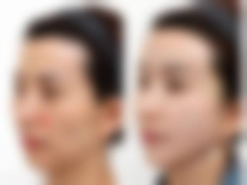 五、南京白下天熙整形医疗美容诊所怎么预约：