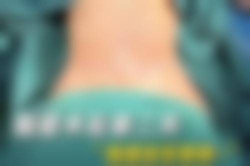 陈增红医生怎么预约？