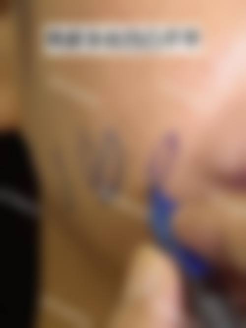 陈增红医生实例