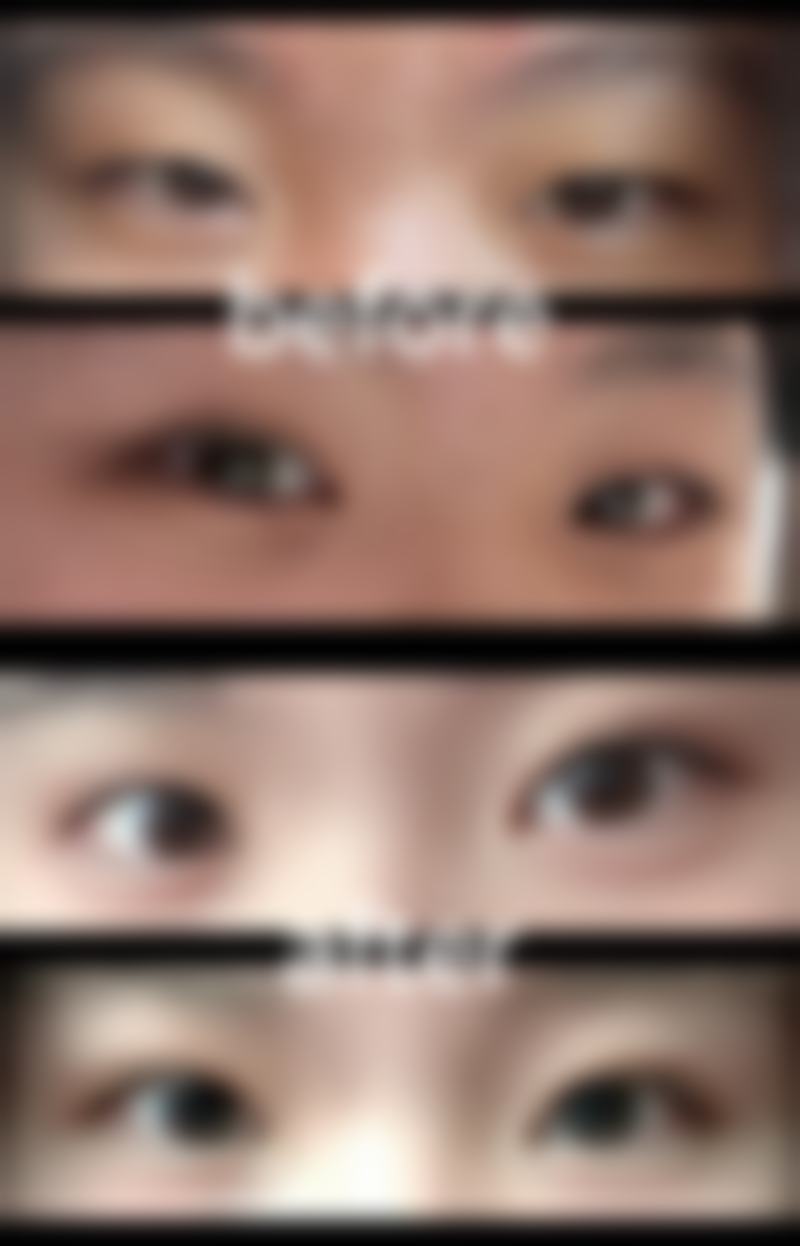 佘雨虹医生怎么预约?