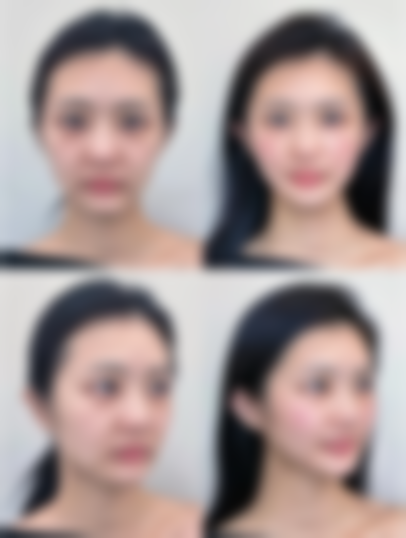 佘雨虹医生口碑和评价