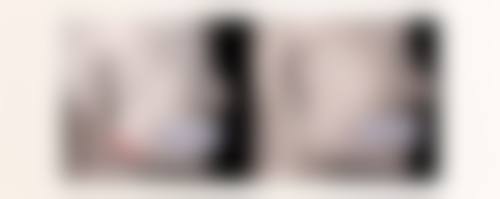 割双眼皮术后注意事项总结