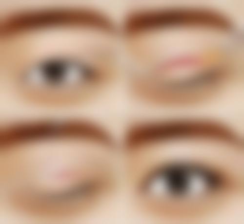 四、湖南常德美莱整形实例