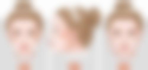 埋线和全切双眼皮哪个更好？揭秘两者在持久度、恢复速度与效果自然度上的独特优势 