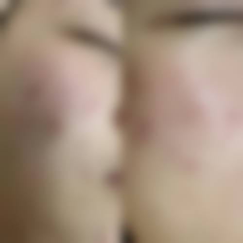 五、来宾保丽医疗美容诊所实例