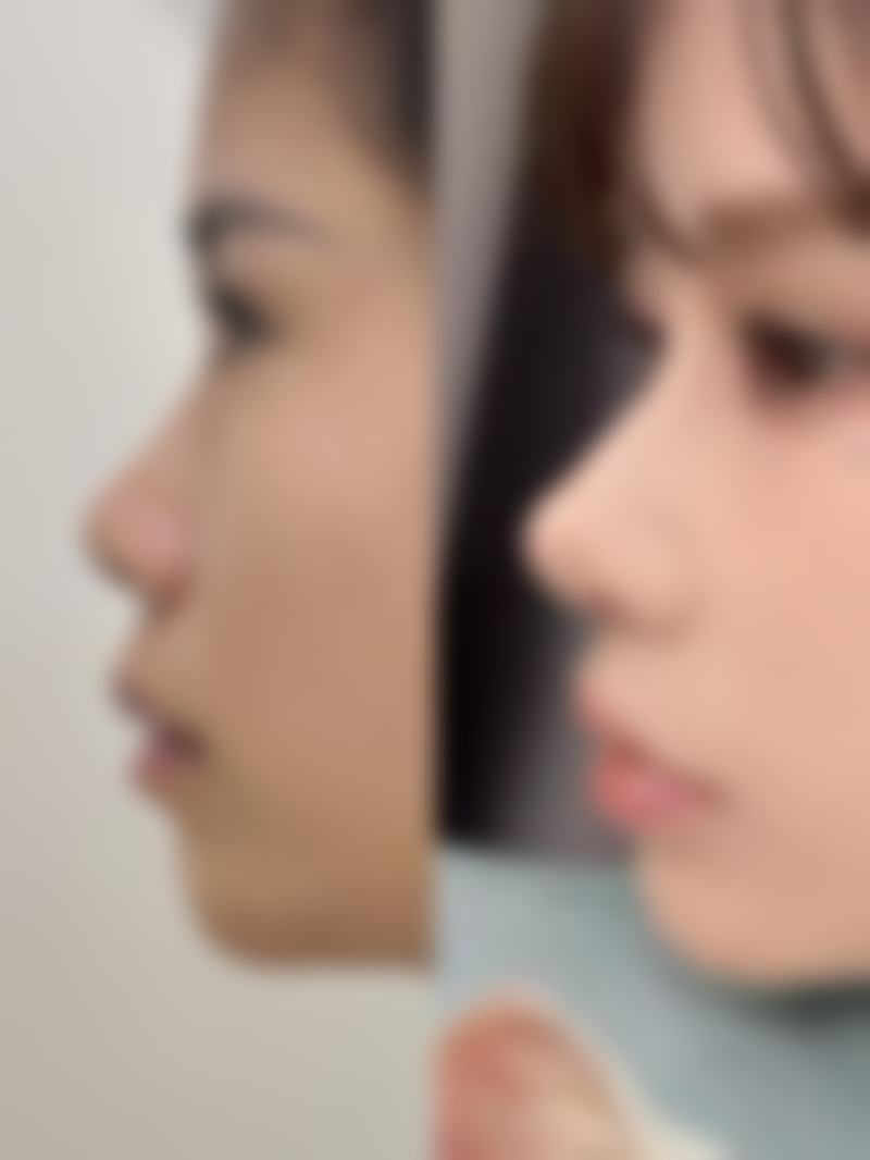 五、孝义华美整形医院怎么预约：