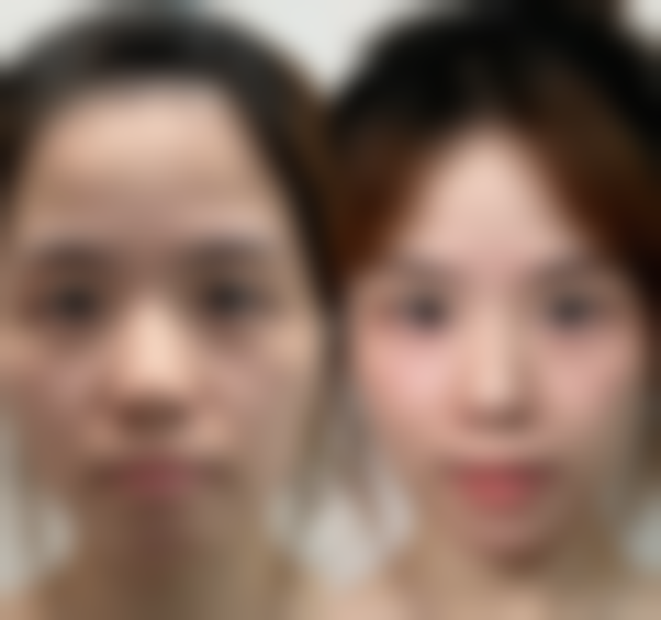 七、宜昌聚星医疗美容诊所真实的顾客评价如下: