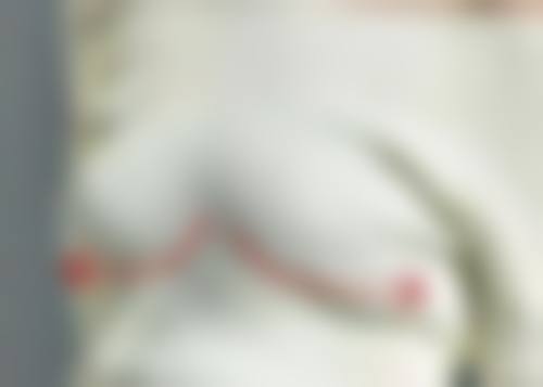 手术疤痕如何淡化？综合手段+专业方案，助力疤痕改善与外观提升 