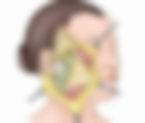 手术疤痕淡化：手术治疗方案来助力