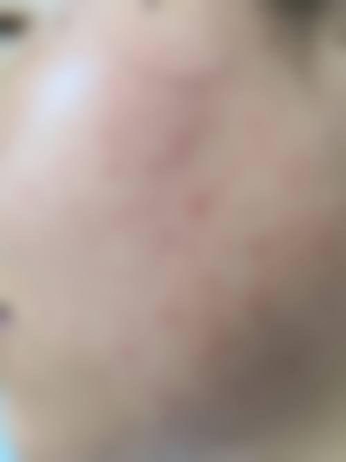 八、新疆雅玲医疗美容诊所真实的顾客评价如下: