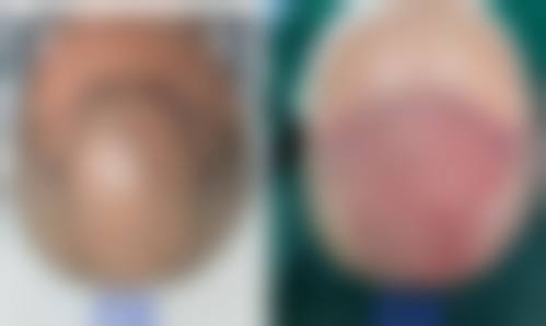 六、韩国O&YOUNG整形外科怎么预约: